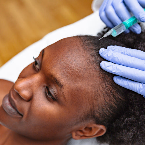 The Complete Guide to Traction Alopecia
